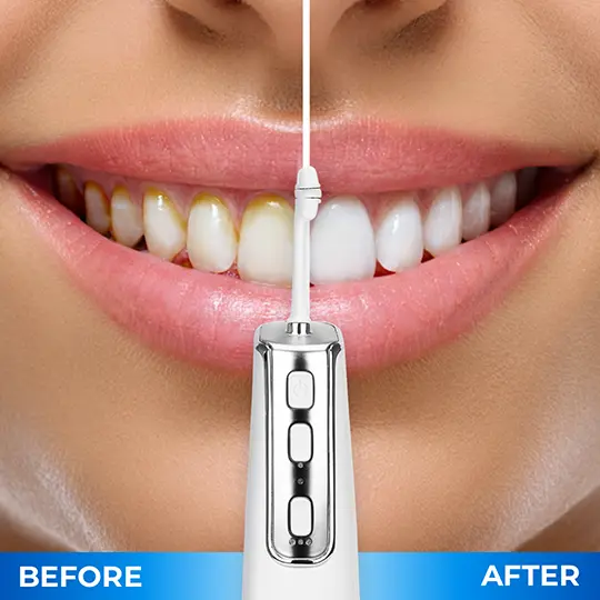 Miracle Smile Magic Flosser 10